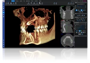Rtg Dental virtual